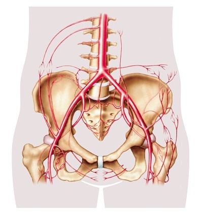 Leriche Syndrome