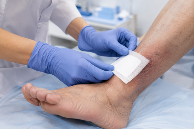Non-Healing Foot Wounds