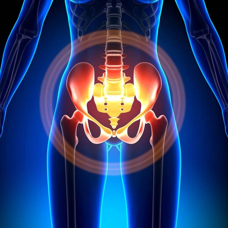Leriche Syndrome
